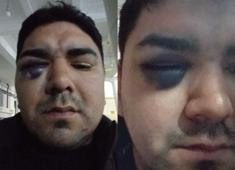 Cómo quedó la víctima a la que golpearon.